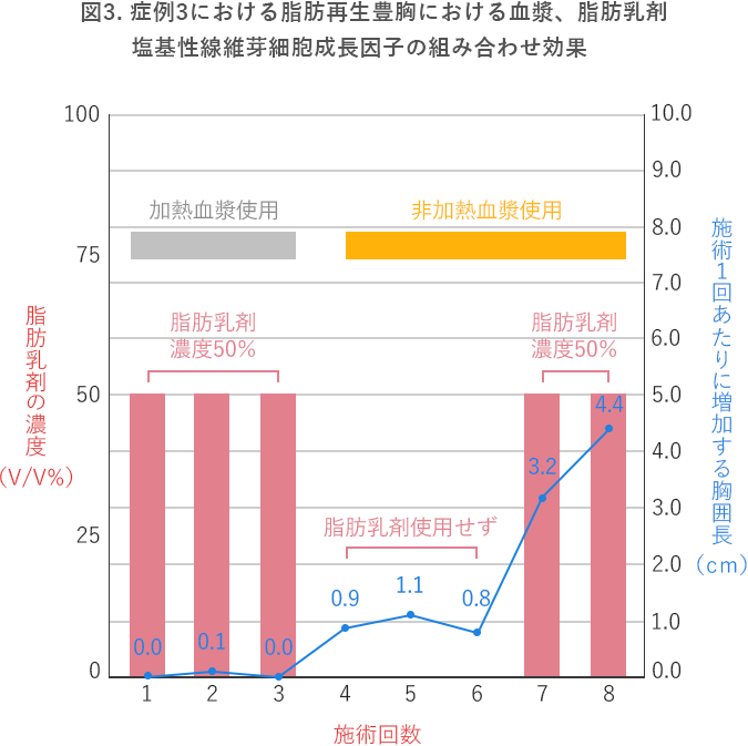 脂肪再生豊胸のその他のq A 豊胸失敗を成功に変えるために読むサイト