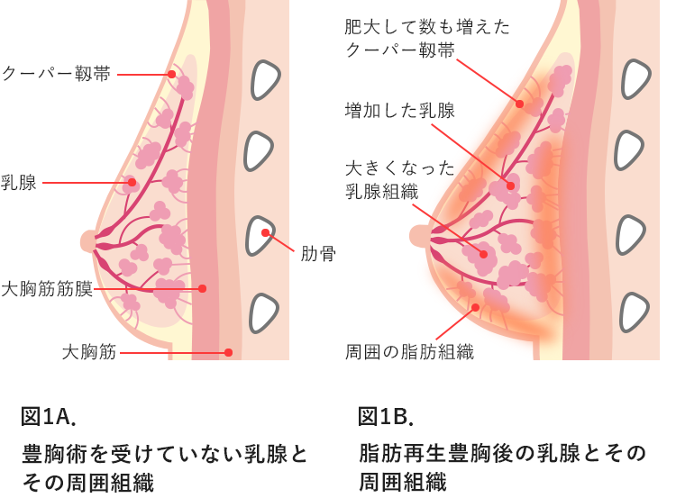 脂肪再生豊胸のその他のq A 豊胸失敗を成功に変えるために読むサイト