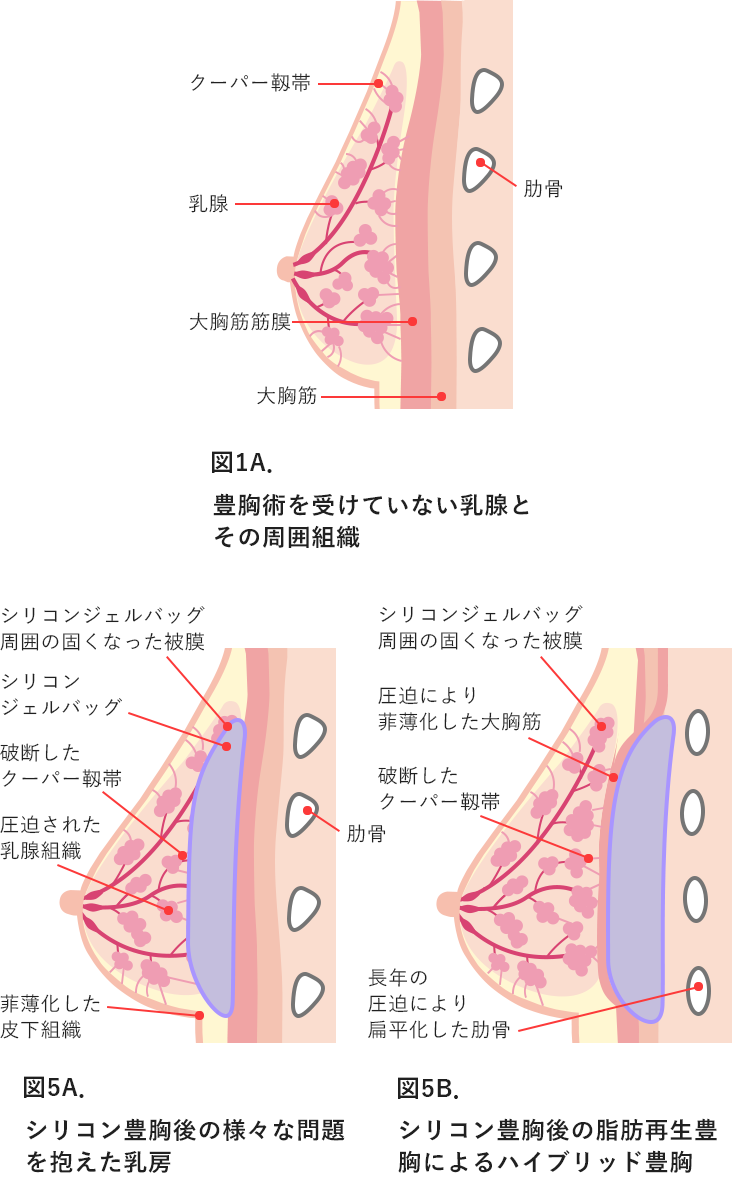 クーパー 靭帯 再生